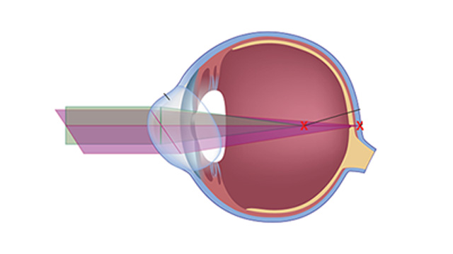 Eye Care in Bellefonte