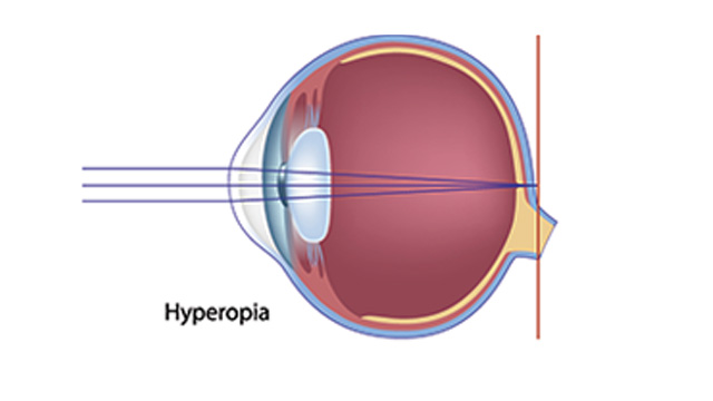 Optometrist in Bellefonte